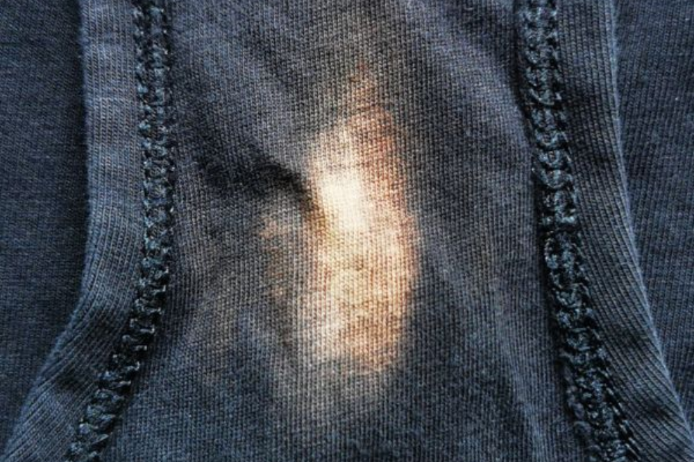 Why does my underwear stain even after washing?